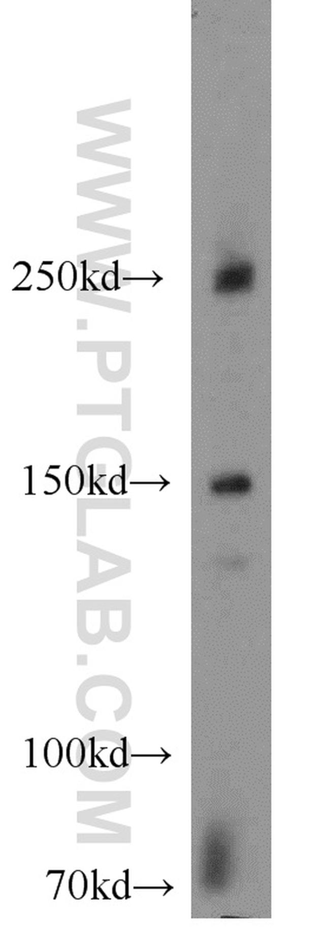 NPHP4 Antibody in Western Blot (WB)