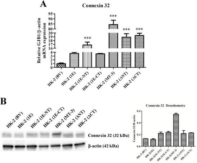 Connexin 32 Antibody in Western Blot (WB)