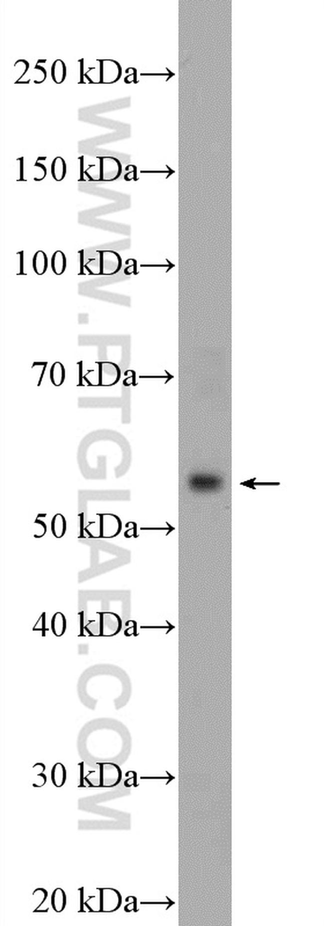 HTR7 Antibody in Western Blot (WB)