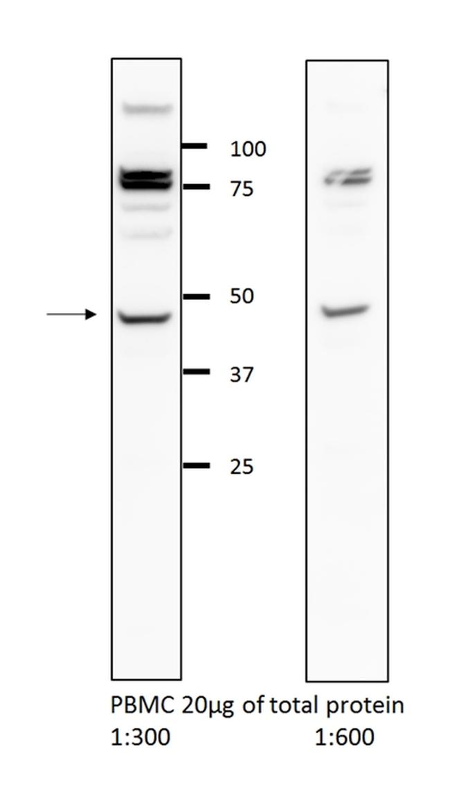 GLRA2 Antibody in Western Blot (WB)