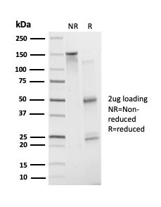 ATF2 Antibody in SDS-PAGE (SDS-PAGE)