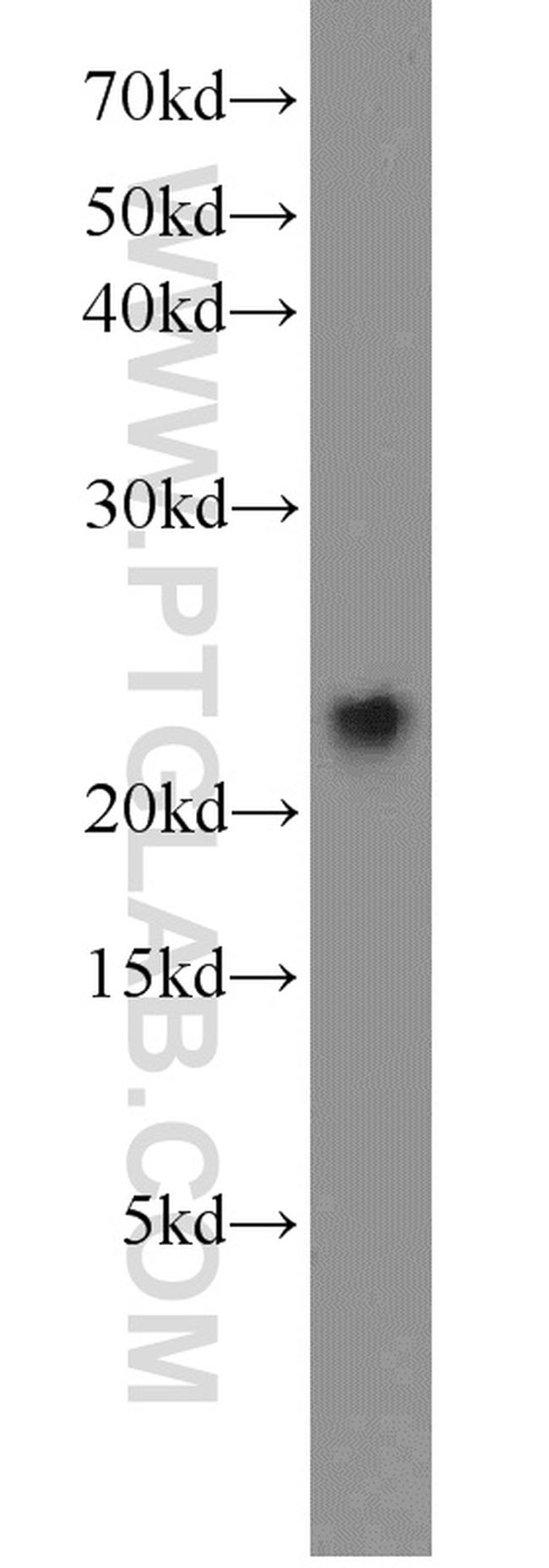 VILIP-1 Antibody in Western Blot (WB)