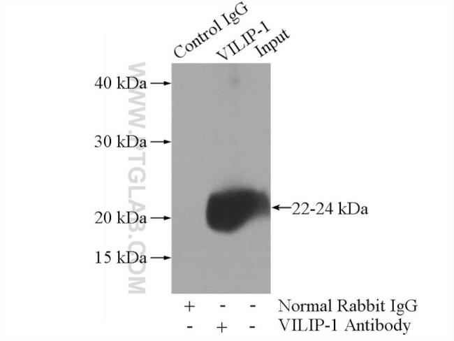 VILIP-1 Antibody in Immunoprecipitation (IP)