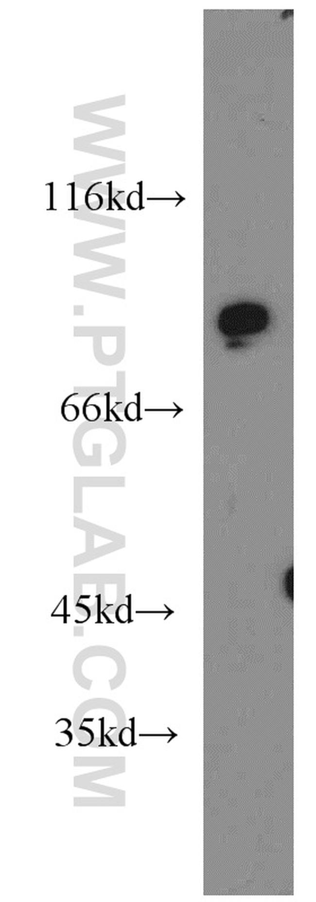 PDE8A Antibody in Western Blot (WB)