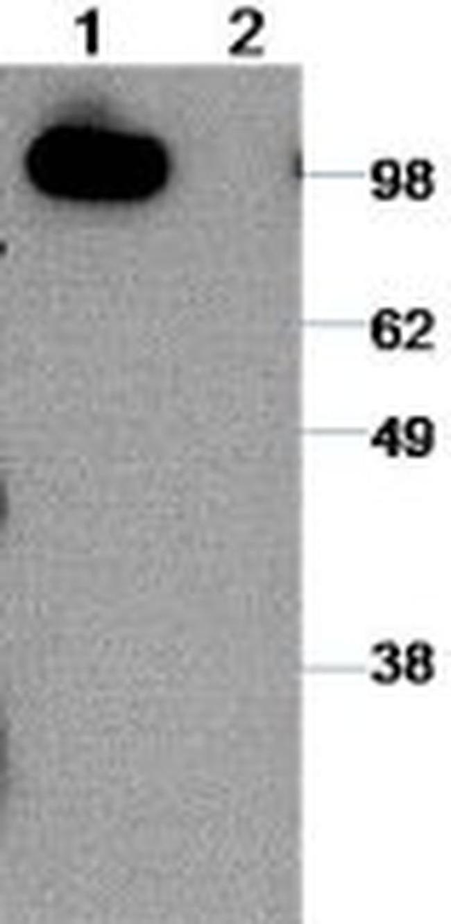 CD324 (E-Cadherin) Antibody in Western Blot (WB)