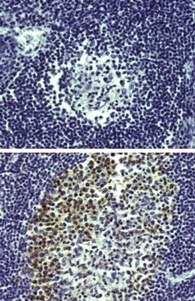Rat IgG2a kappa Isotype Control in Immunohistochemistry (Paraffin) (IHC (P))