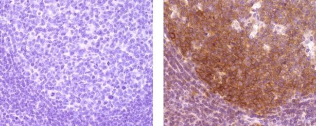Mouse IgG2a kappa Isotype Control in Immunohistochemistry (Paraffin) (IHC (P))