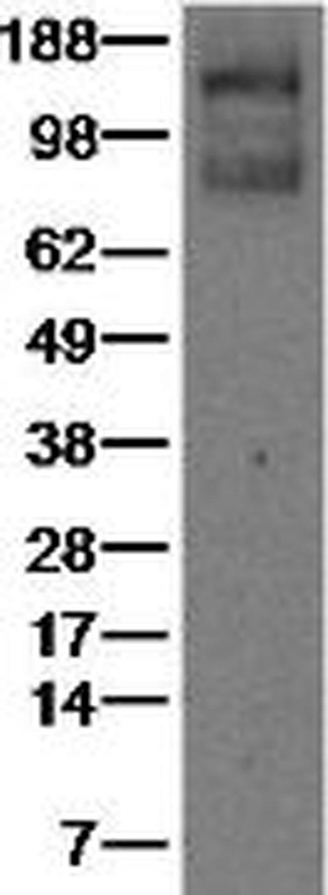 VEGF Receptor 1 (Flt1) Antibody in Western Blot (WB)