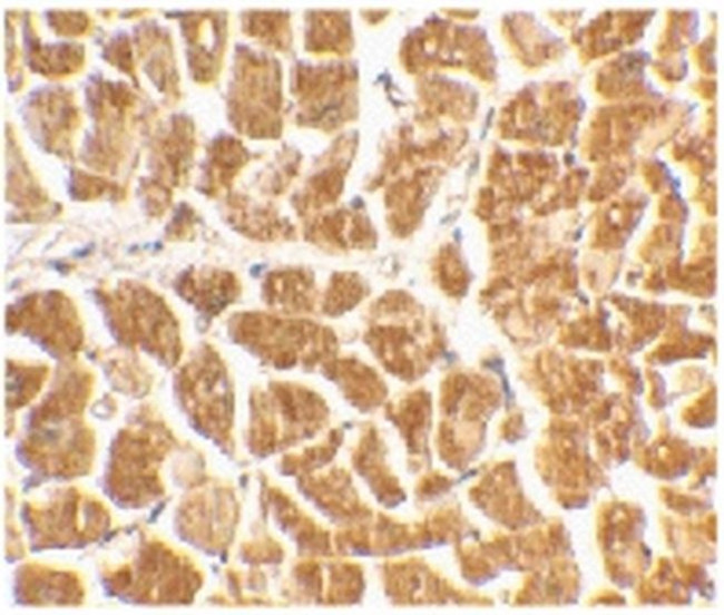 CX3CR1 Antibody in Immunohistochemistry (Paraffin) (IHC (P))