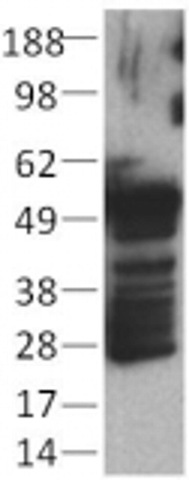 Cytokeratin Pan Type II Antibody in Western Blot (WB)