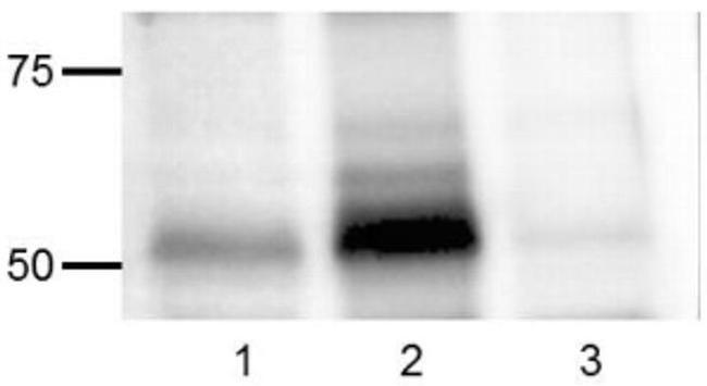 Phospho-SRC (Tyr418) Antibody in Western Blot (WB)