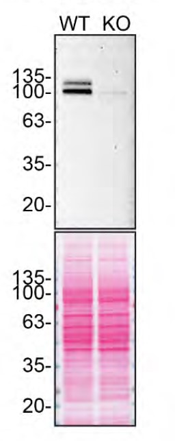 APP (Amyloid Precursor Protein) Antibody in Western Blot (WB)