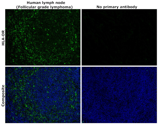 HLA-DR Antibody in Immunohistochemistry (Paraffin) (IHC (P))