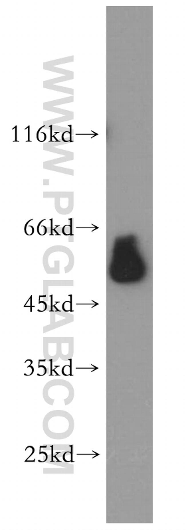 ESRRG Antibody in Western Blot (WB)