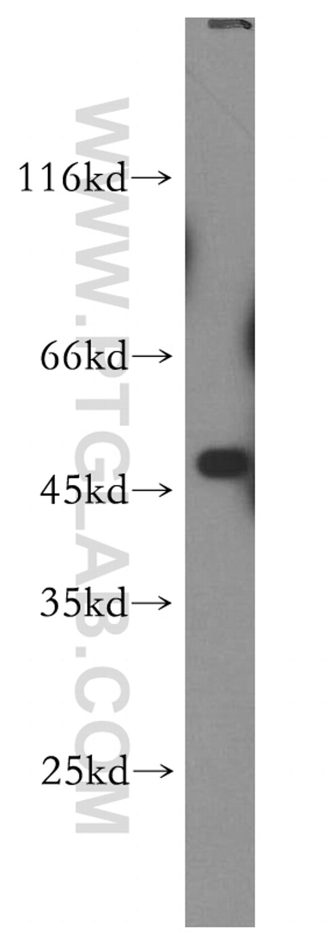 ABHD2 Antibody in Western Blot (WB)