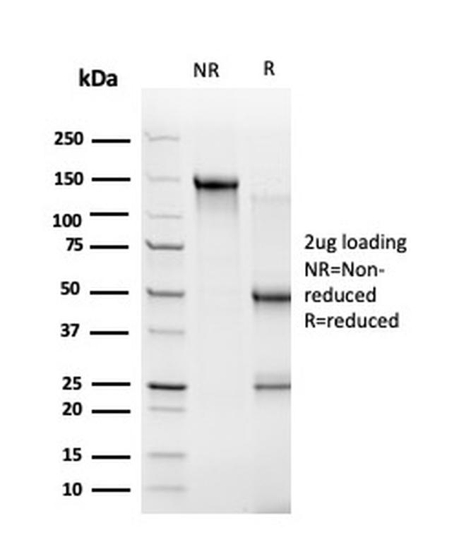 ZBTB46/BTBD4/ZNF340 Antibody in SDS-PAGE (SDS-PAGE)