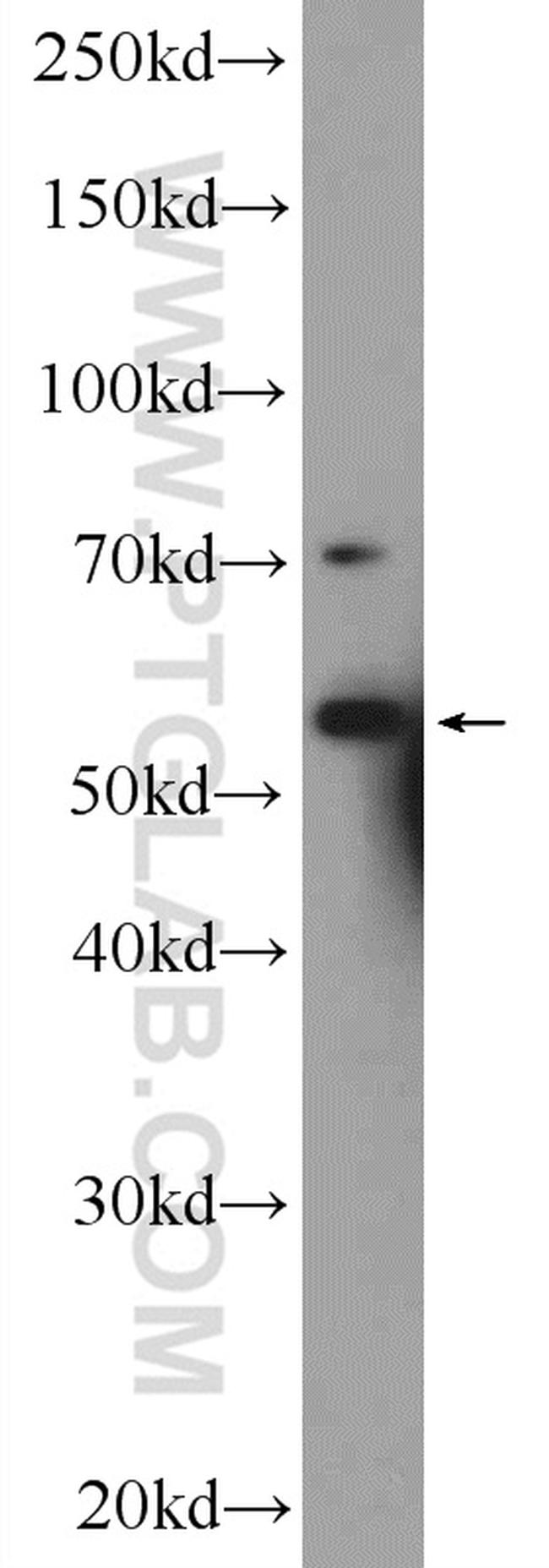 RNF8 Antibody in Western Blot (WB)