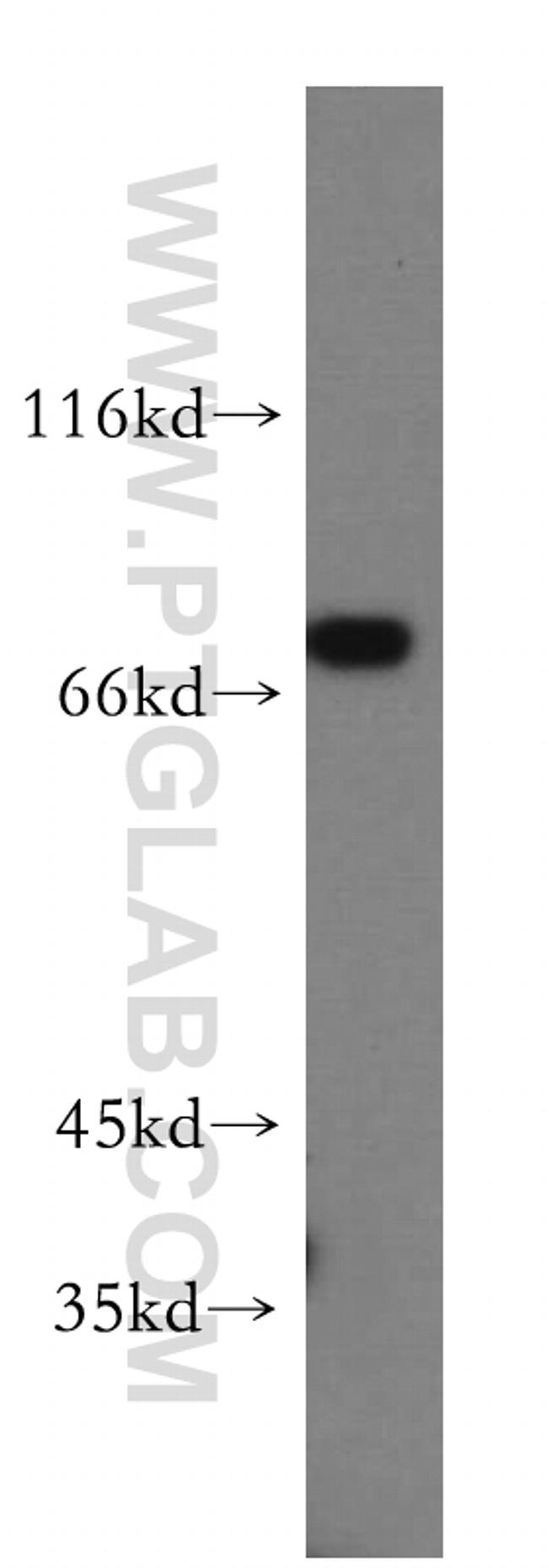 GFPT1 Antibody in Western Blot (WB)