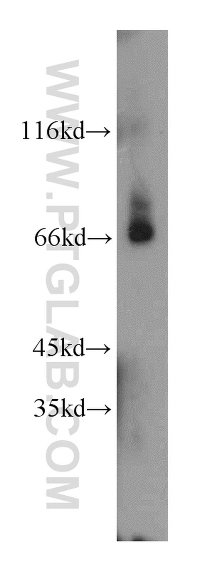 ADAM12 Antibody in Western Blot (WB)