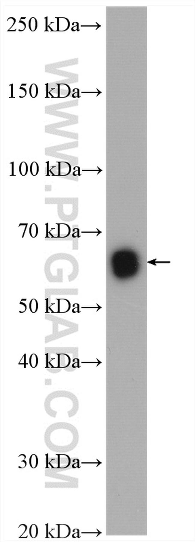 ISYNA1 Antibody in Western Blot (WB)