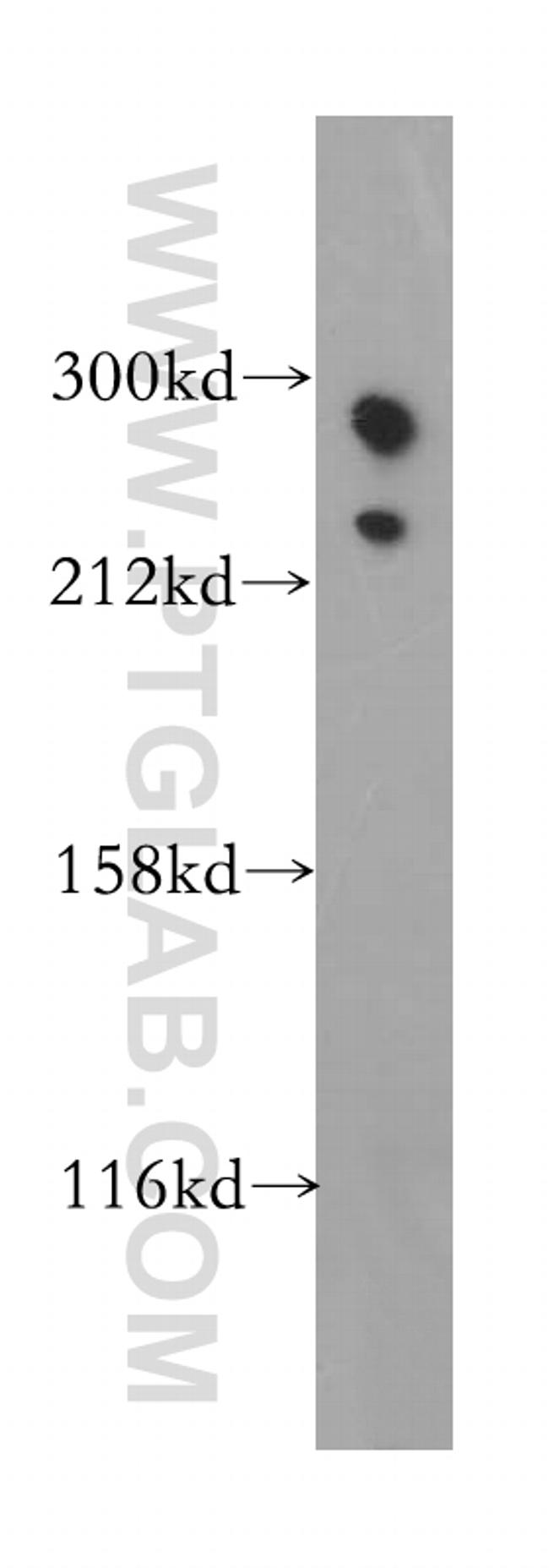 Talin-1 Antibody in Western Blot (WB)