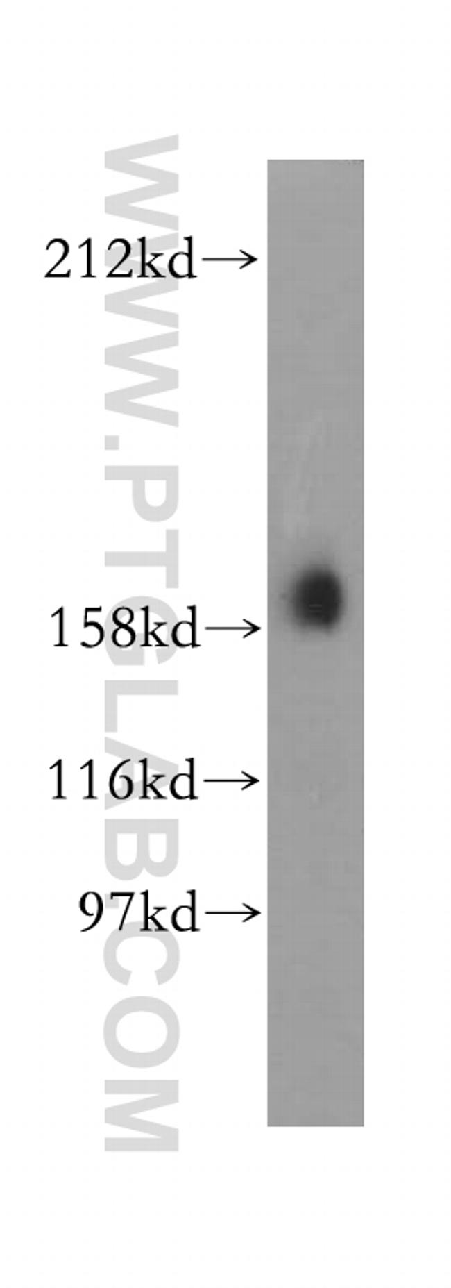 Liprin alpha 1 Antibody in Western Blot (WB)