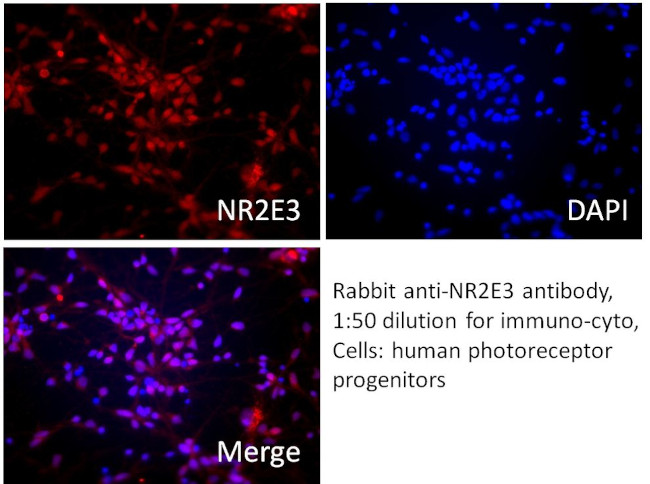 NR2E3 Antibody in Immunocytochemistry (ICC/IF)