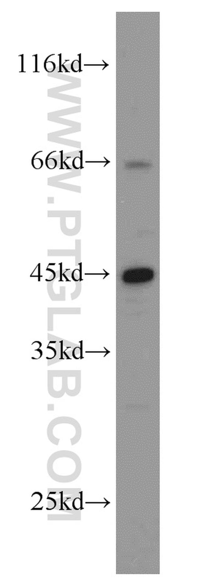NR2E3 Antibody in Western Blot (WB)