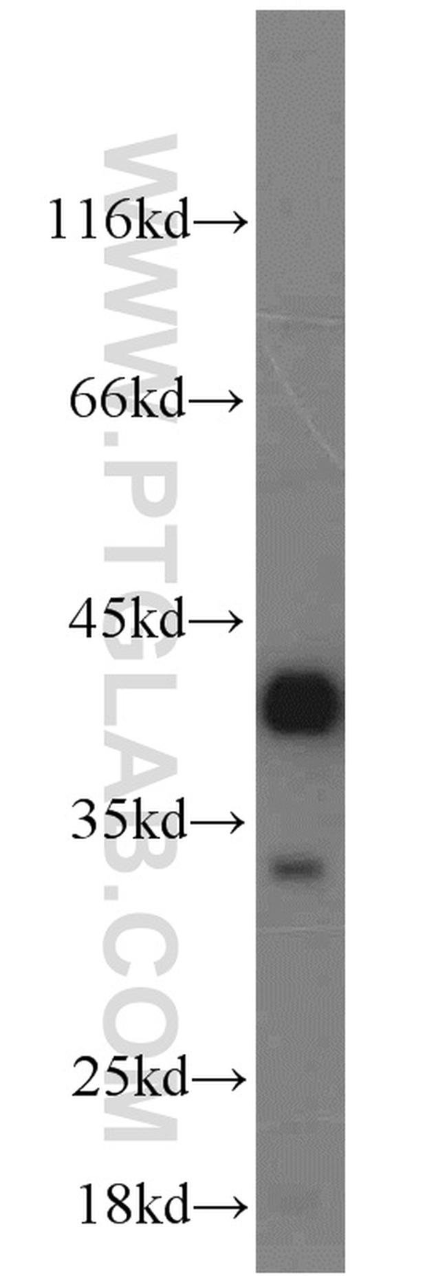 Syntaxin 12 Antibody in Western Blot (WB)