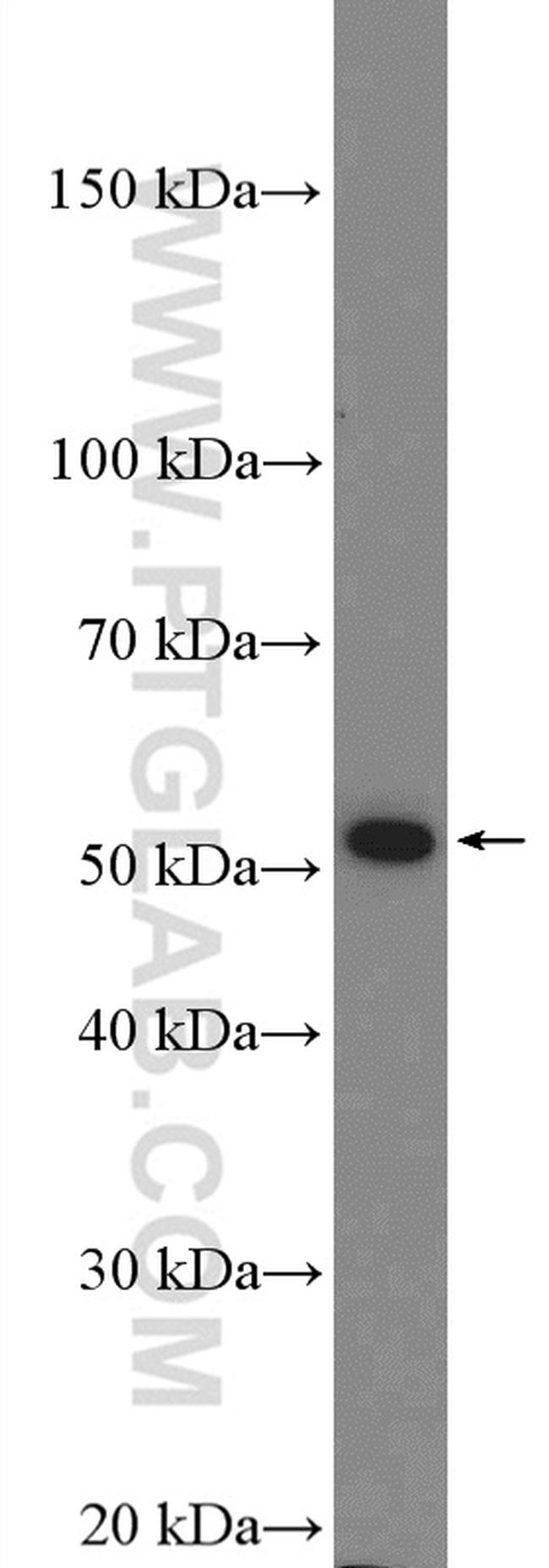 ADRA2A Antibody in Western Blot (WB)