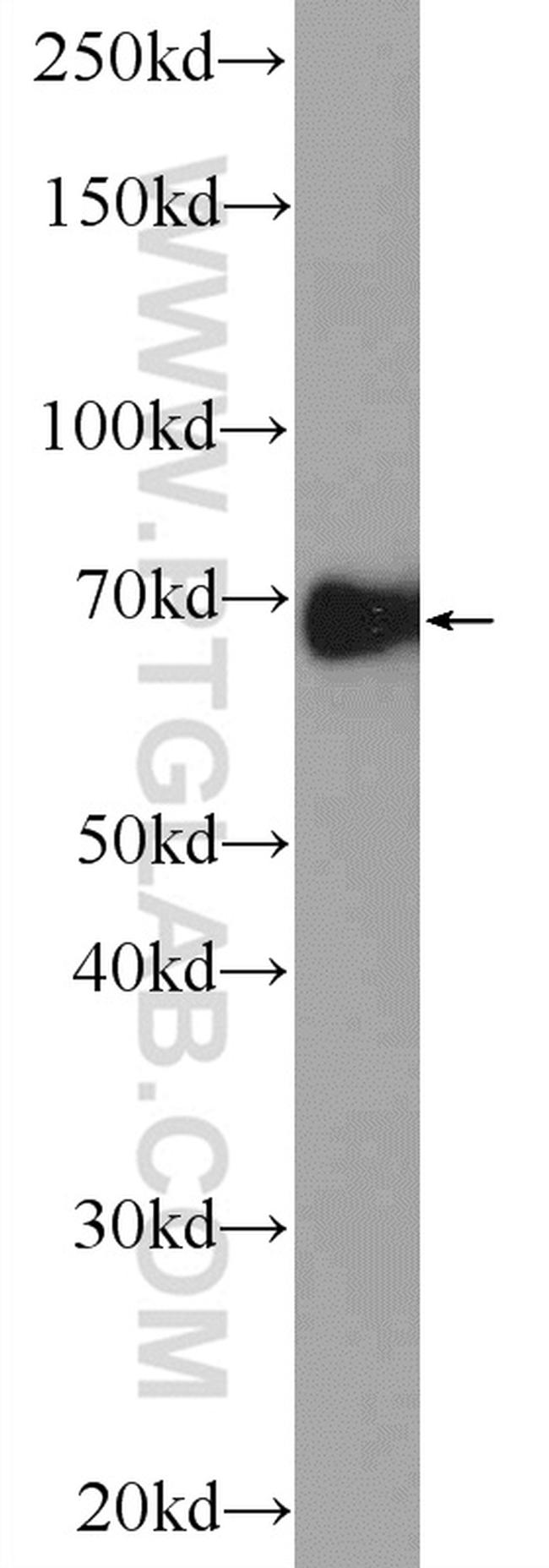 ARNTL Antibody in Western Blot (WB)