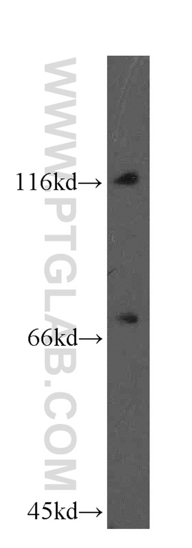 FBXO18 Antibody in Western Blot (WB)