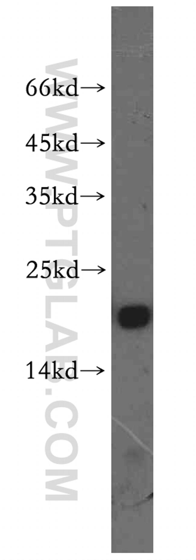 CRCP Antibody in Western Blot (WB)