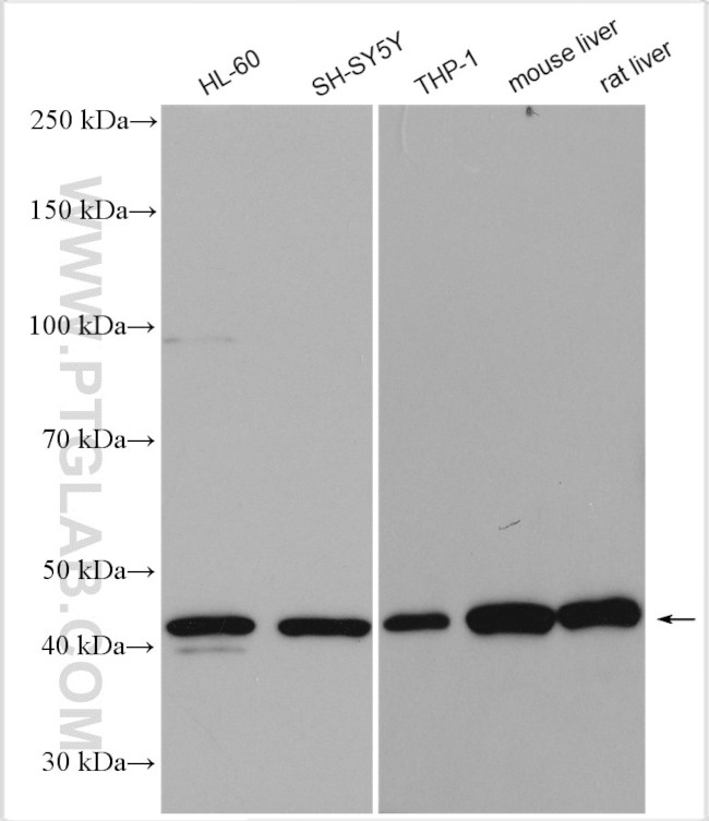 NR1H3 Antibody in Western Blot (WB)