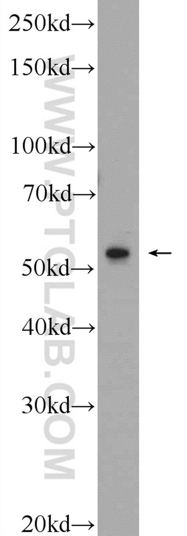 ERG Antibody in Western Blot (WB)