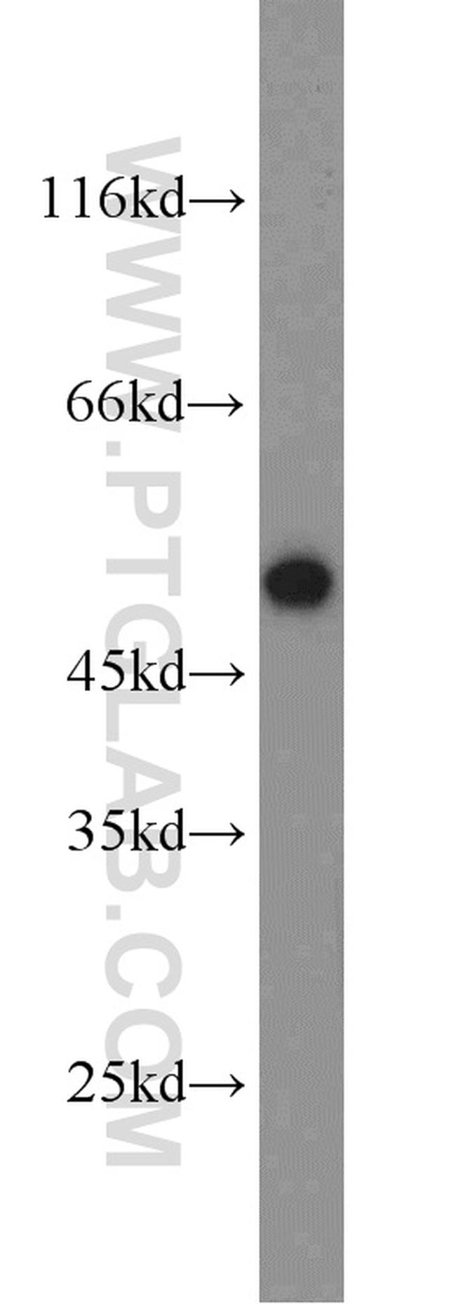 Adiponectin receptor Antibody in Western Blot (WB)