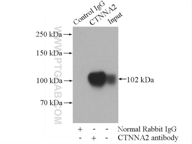alpha N Catenin Antibody in Immunoprecipitation (IP)