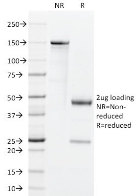 GM-CSF (Granulocyte/Macrophage - Colony Stimulating Factor) Antibody in SDS-PAGE (SDS-PAGE)