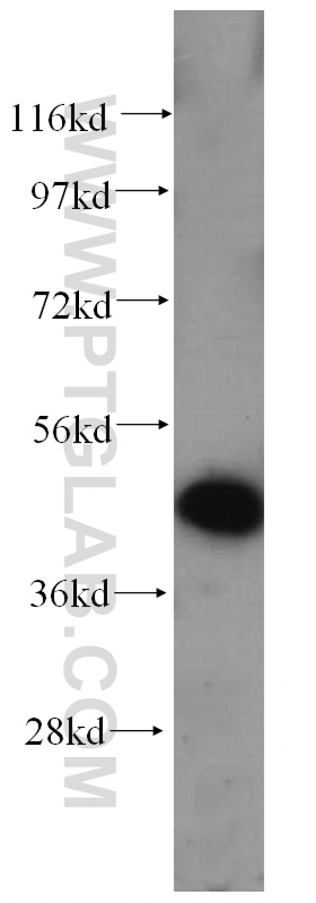 Casein Kinase 1 delta Antibody in Western Blot (WB)