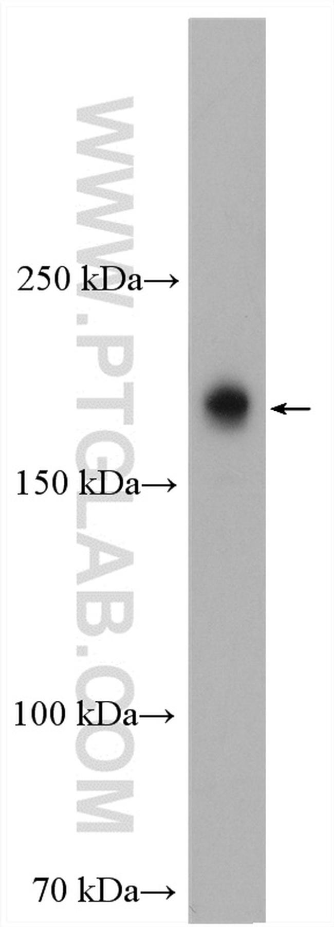 PASK Antibody in Western Blot (WB)