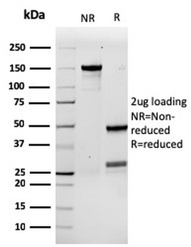 Granulocyte-Colony Stimulating Factor (G-CSF) Antibody in SDS-PAGE (SDS-PAGE)