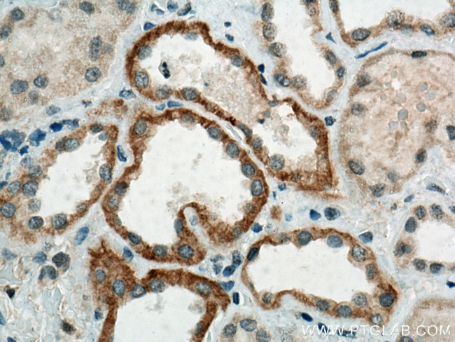 CLCNKA Antibody in Immunohistochemistry (Paraffin) (IHC (P))
