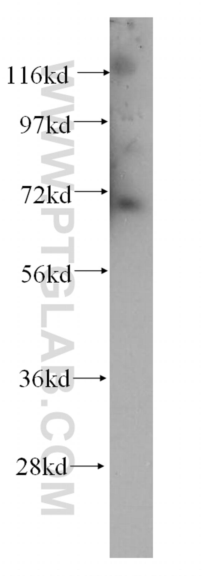 CLCNKA Antibody in Western Blot (WB)