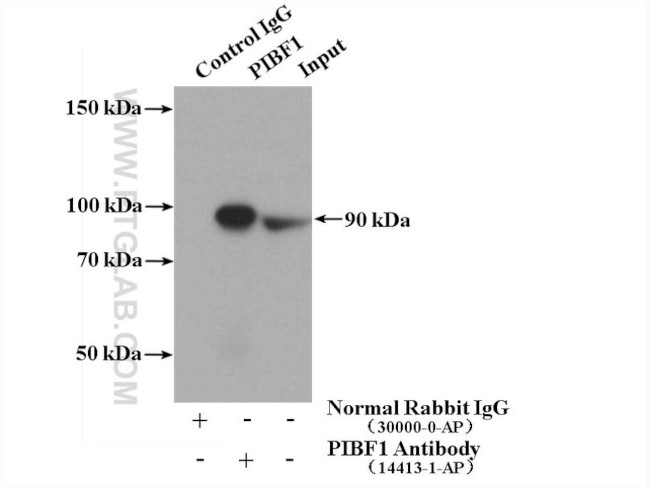 PIBF1 Antibody in Immunoprecipitation (IP)