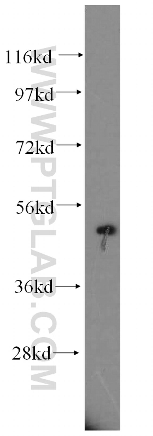 CYP17A1 Antibody in Western Blot (WB)