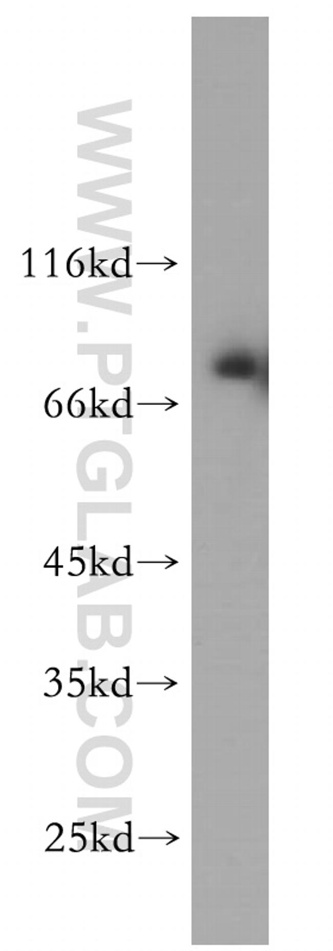 TFE3 Antibody in Western Blot (WB)