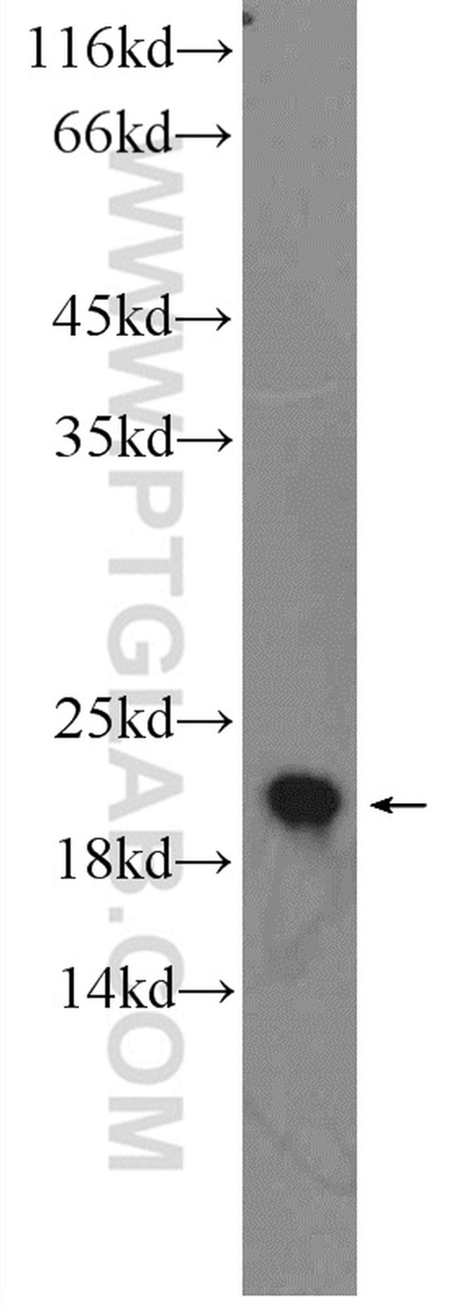 LMP2 Antibody in Western Blot (WB)