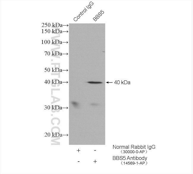 BBS5 Antibody in Immunoprecipitation (IP)