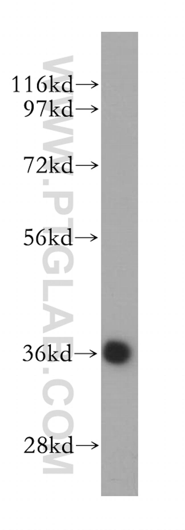 DEDD2 Antibody in Western Blot (WB)
