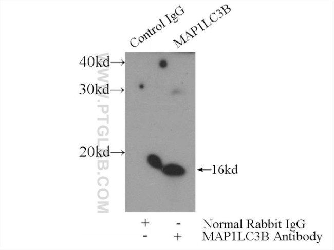 LC3 Antibody in Immunoprecipitation (IP)